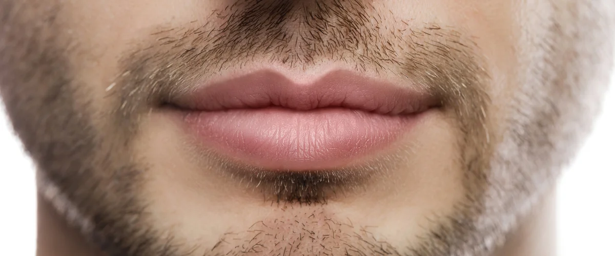 Erkeklerde Lip Lift Ameliyatı